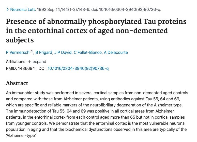 80 neurosci lett