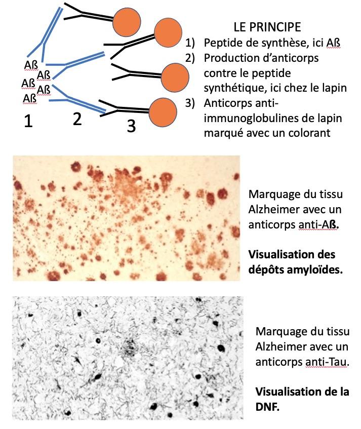 Immunomarquage des le sions